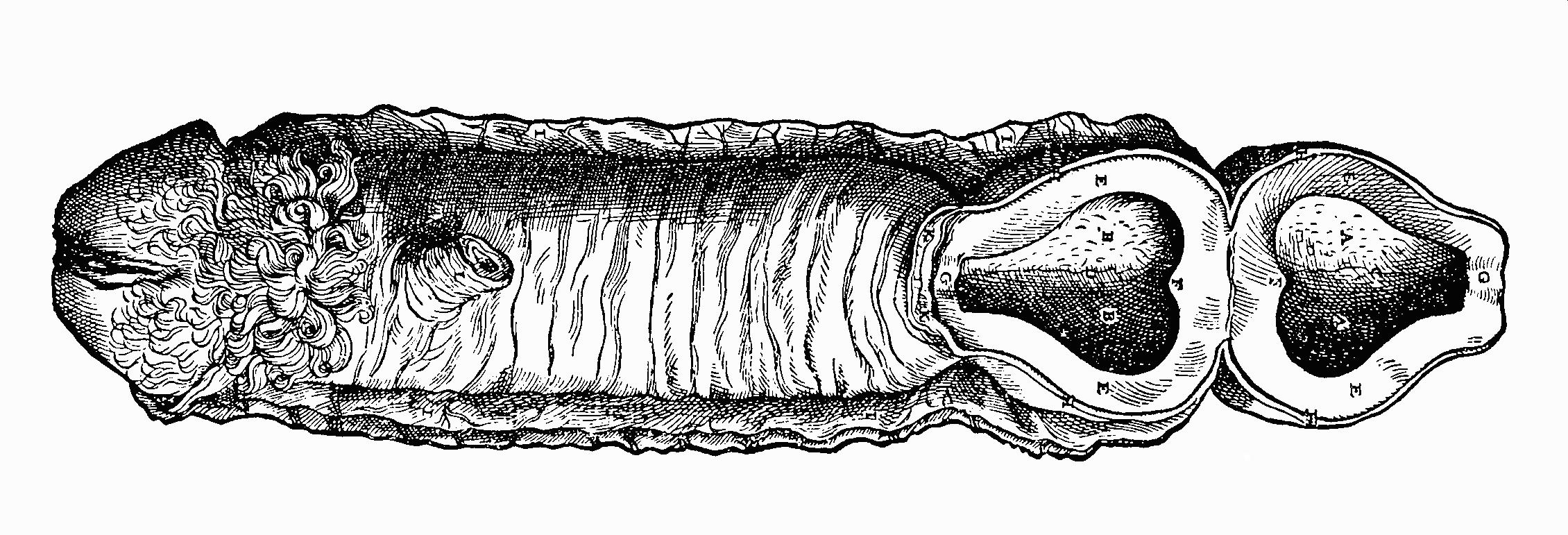 Vesalius' uterus as penis